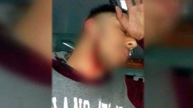 Atacaron a un colectivero en Villa Fiorito: le cortaron el cuello para robarle Atacaron a un colectivero en Villa Fiorito: le cortaron el cuello para robarle