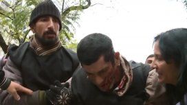 Incidentes entre los manifestantes y la policía en el acampe frente a Desarrollo Social: hay heridos y un detenido Incidentes entre los manifestantes y la policía en el acampe frente a Desarrollo Social: hay heridos y un detenido