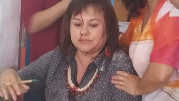 La docente sufrió varios golpes y cortes en la cabeza, hombros y brazos