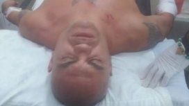 El boxeador habría sido víctima de un robo El boxeador habría sido víctima de un robo