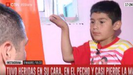 Conmovedor: le trasplantaron un dedo del pie a la mano tras la detonación de un explosivo Conmovedor: le trasplantaron un dedo del pie a la mano tras la detonación de un explosivo