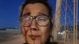 Fue víctima de violencia de género durante nueve años hasta que huyó al Chaco Fue víctima de violencia de género durante nueve años hasta que huyó al Chaco