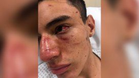 Brutal golpiza a un rugbier: lo dejaron inconsciente Brutal golpiza a un rugbier: lo dejaron inconsciente
