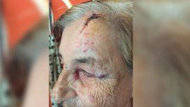 Una pareja de abuelos vive aterrorizada por los golpes y amenazas de su nieto Una pareja de abuelos vive aterrorizada por los golpes y amenazas de su nieto