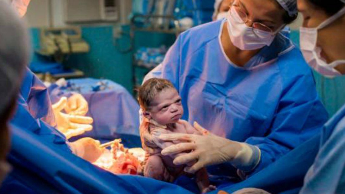 La increíble foto de la beba que nació enojada que causa furor en las redes