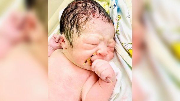 Vietnam: un niño nació con el DIU de su madre en la mano y se volvió viral