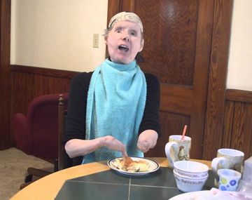 Así vive la mujer que recibió  un trasplante de cara