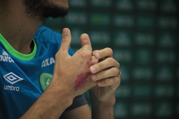 Las manos aún heridas de Hélio Zampier Neto