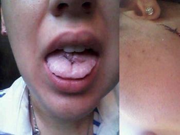 Apuñaló a su ex novia y sólo estuvo preso dos horas