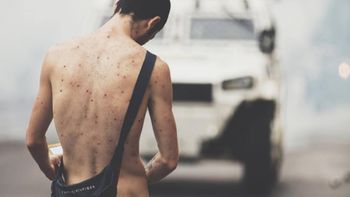 Manifestante desnudo en una autopista de Caracas se viralizó Manifestante desnudo en una autopista de Caracas se viralizó