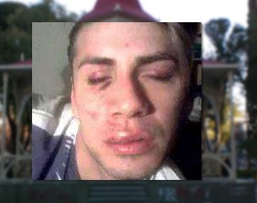 Lo golpearon por ser gay a la salida de un boliche en Trelew