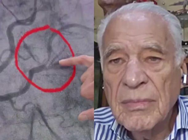 Alberto Cormillot relató el susto que vivió por un dolor en el pecho: qué le pasó