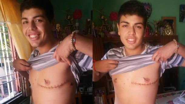 Un joven de 16 años vive con una bala alojada en el corazón