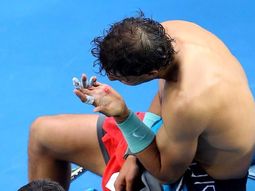 mira las fotos de la zurda de rafael nadal en carne viva mira las fotos de la zurda de rafael nadal en carne viva