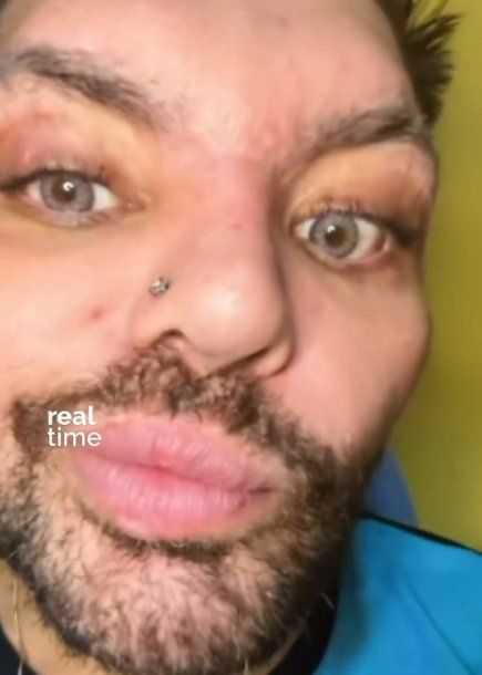 Fran Mariano reveló que se puso los ojos de Barby Franco: El colorcito