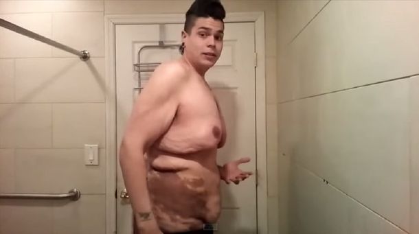 Un joven se animó a mostrar cómo quedó su cuerpo tras perder 122 kilos