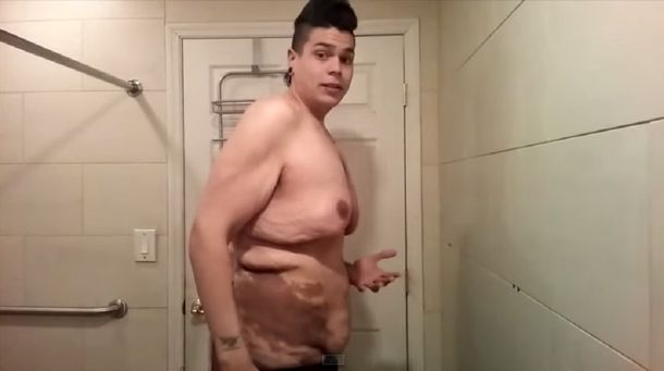 Un joven se animó a mostrar cómo quedó su cuerpo tras perder 122 kilos