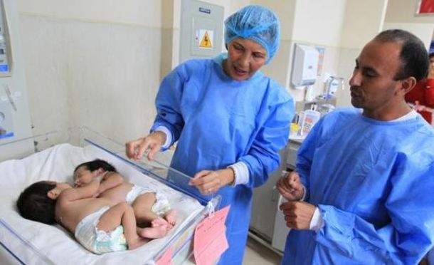 Después de ocho horas de operación, dos siamesas son separadas con éxito