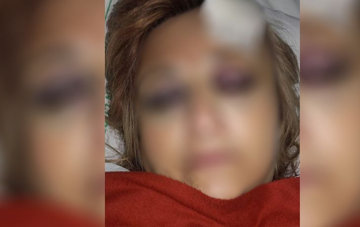 Atacó a batazos a los padres de una chica a la que violó cuando era una niña