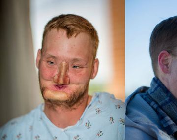 Antes y después de Andy Sandness