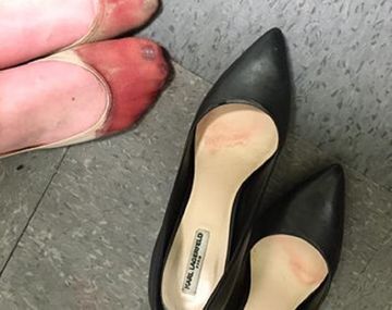 La obligó a usar tacones hasta sangrar