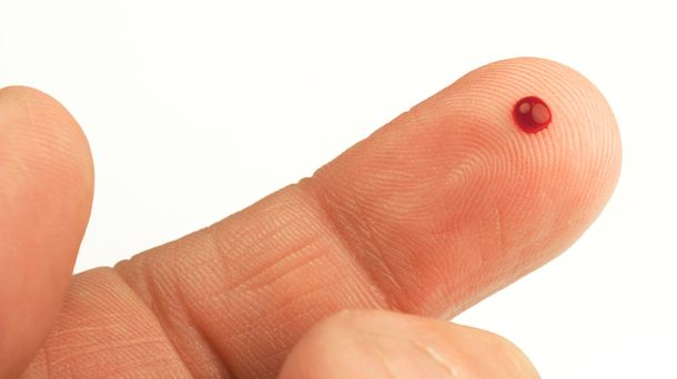 Un análisis de sangre permite saber todos los virus que afectaron a una persona