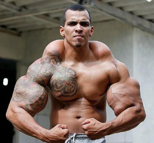 Un Hulk humano casi pierde los brazos tras inyectarse aceite en los bíceps