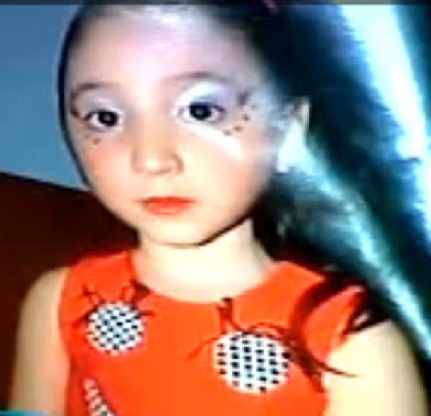 Trasplantan a una nena que vivía conectada a un corazón artificial