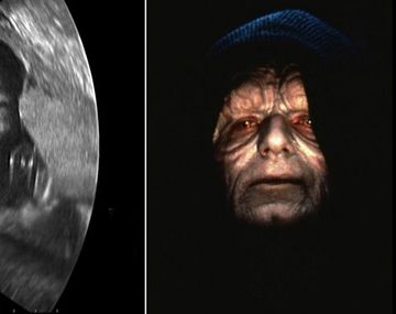 Se hace una ecografía y aparece el rostro del emperador de Star Wars