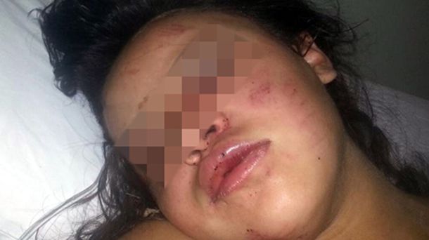 Una chica embarazada denunció una brutal golpiza de su ex