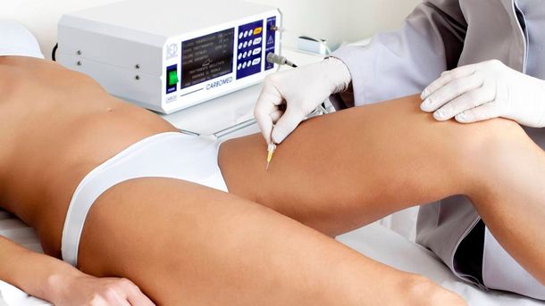 Entre Ríos: una mujer murió tras un tratamiento de carboxiterapia