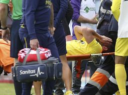 fractura expuesta para un defensor de la seleccion; se pierde la copa america fractura expuesta para un defensor de la seleccion; se pierde la copa america