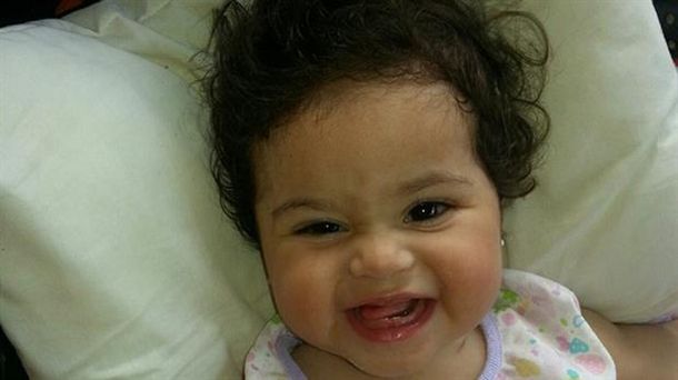 Dieron de alta a Luciana, la siamesa que sobrevivió a la operación en el Hospital Posadas