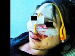tiene de 16 anos y su novio la desfiguro a golpes por abrir una cuenta de facebook tiene de 16 anos y su novio la desfiguro a golpes por abrir una cuenta de facebook