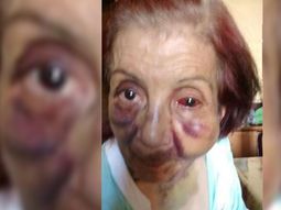 brutal golpiza a una anciana discapacitada en un geriatrico de mendoza brutal golpiza a una anciana discapacitada en un geriatrico de mendoza