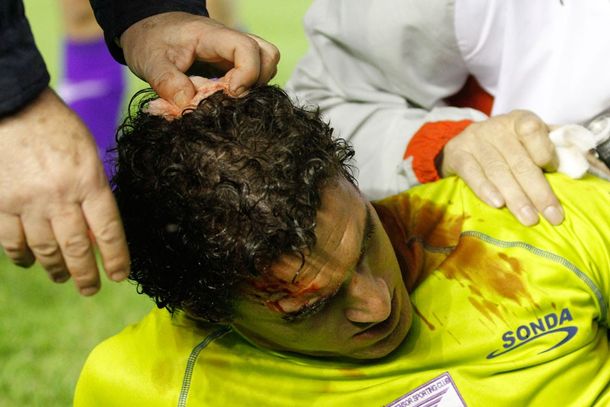 Silva arquero defensor sangre