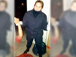 Se sacó una foto con el brazo de un accidentado y la subió a Facebook