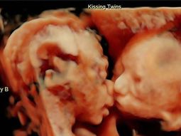 Isabella y Callie en la imagen más tierna