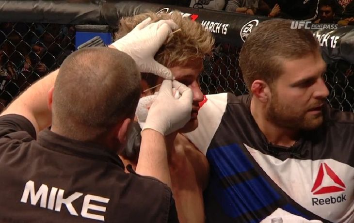 Los lindos también caen: el sex symbol de la UFC perdió su invicto