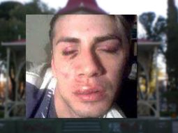 lo golpearon por ser gay a la salida de un boliche en trelew lo golpearon por ser gay a la salida de un boliche en trelew