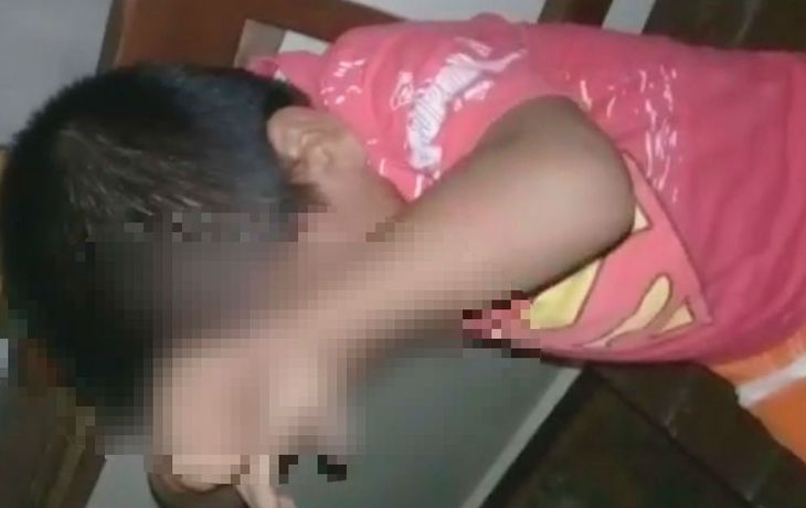 El niño agredido se protegía como podía de los golpes de su madre