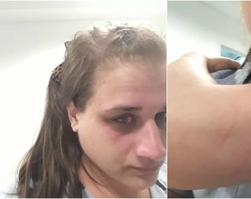 Stella Vázquez, la joven agredida