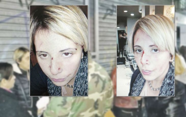 Dora Tula fue agredida por el dueño de la peluquería en la que trabajaba
