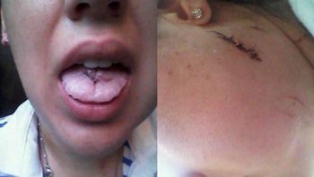 apunalo a su novia hasta casi matarla y solo estuvo preso dos horas apunalo a su novia hasta casi matarla y solo estuvo preso dos horas