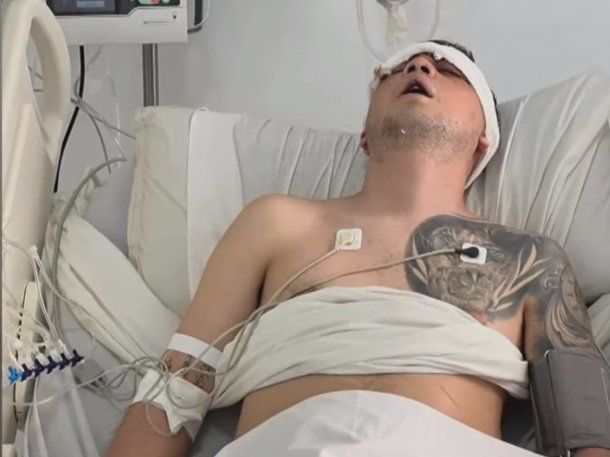 Tucumán: brutal agresión a un joven en un boliche