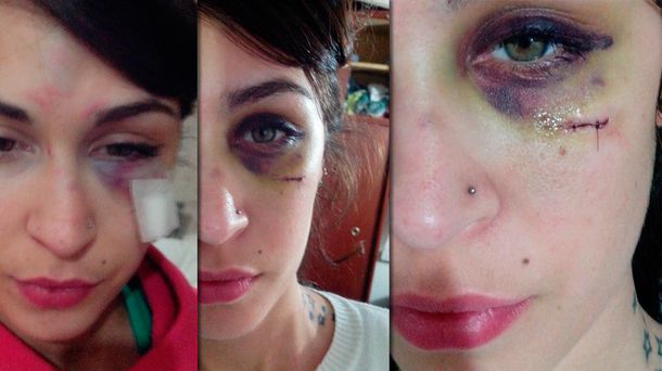 En primera persona: su ex la golpeó por celos y lo contó por Facebook