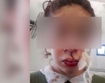 Otro caso de violencia en un control policial: la golpearon hasta sacarle los dientes