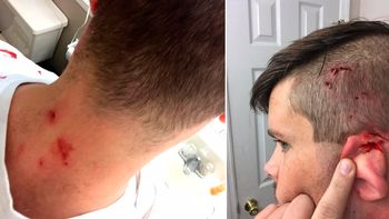 Un joven fue atacado por su gato en Navidad Un joven fue atacado por su gato en Navidad