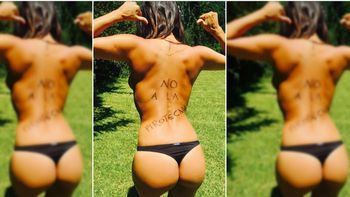 Silvina Escudero, contra la pirotecnia Silvina Escudero, contra la pirotecnia