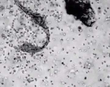 Así atacan los glóbulos blancos a un virus cuando entra a tu organismo